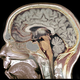 Illustration for article titled A sleep disorder can reveal you have Parkinson's - 50 years before you develop the disease